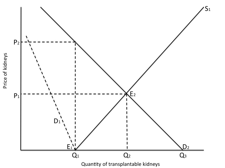 Figure 1. The Supply and Demand for Transplantable Kidneys